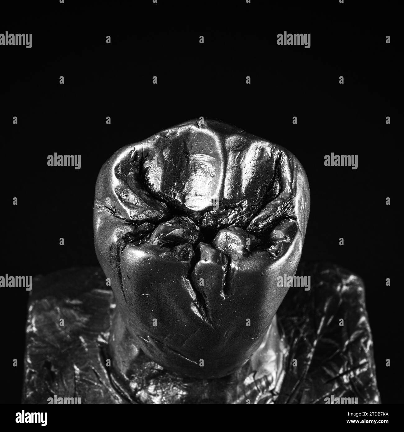 ceramic crowns and veneers Stock Photo Alamy