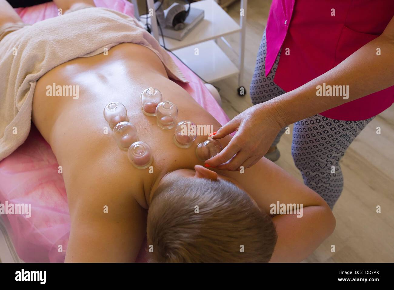 Traditional Chinese Cupping Therapy on the Back by Naturopath. Chinese Cup. Naturotherapy, massages, alternative medicine, natural medicine. Stock Photo