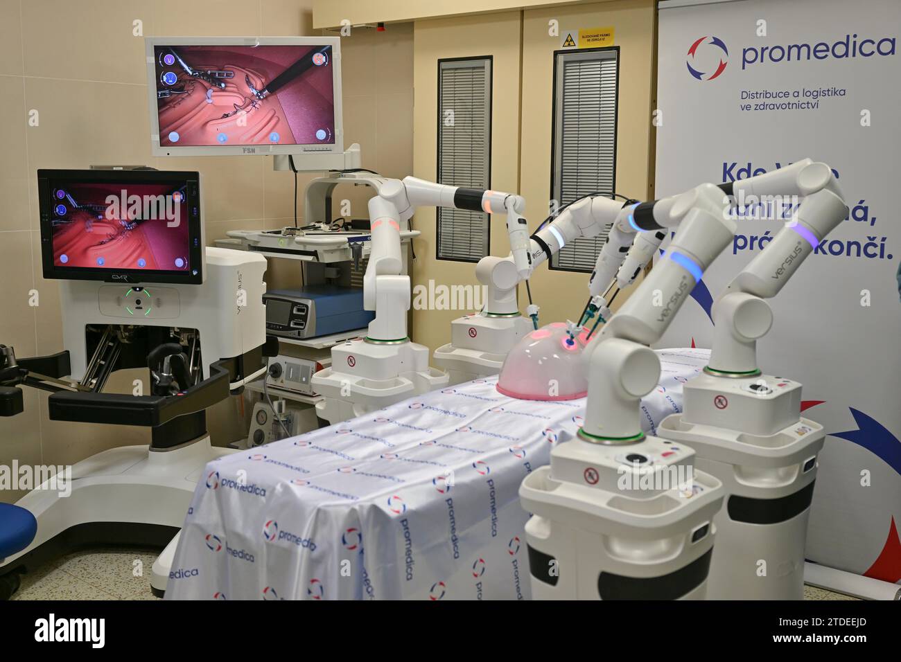 Launch of operation of robotic surgical operation system Versius at