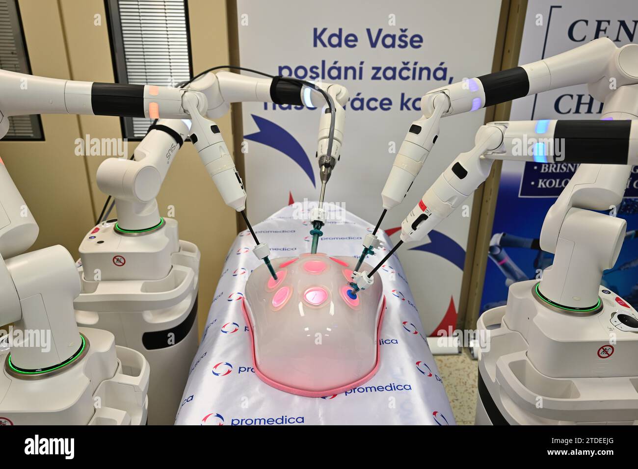 Launch of operation of robotic surgical operation system Versius at