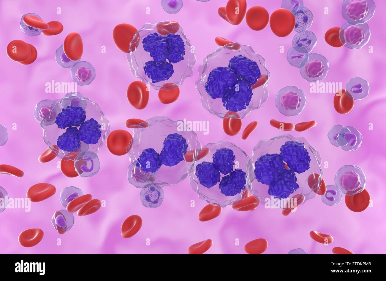 Follicular lymphoma (FL) cells in blood flow - isometric view 3d illustration Stock Photo