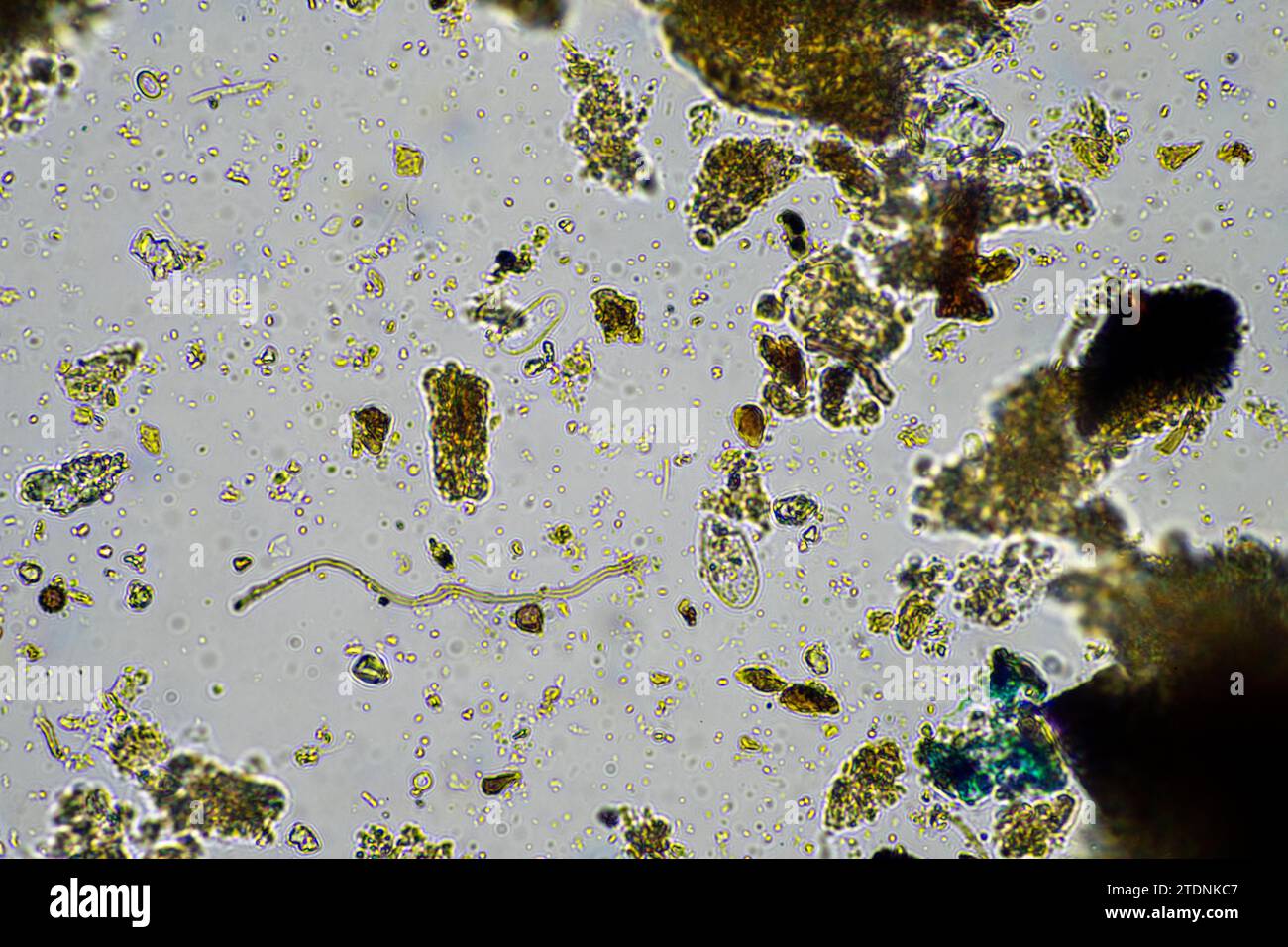 soil microorganism under the microscope recycling nutrients in a compost on a regenerative agriculture farm in australia, showing amoeba, fungi, funga Stock Photo