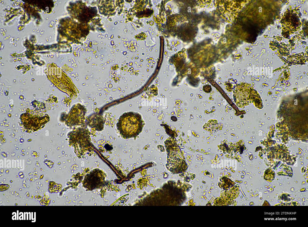 soil microorganism under the microscope recycling nutrients in a compost on a regenerative agriculture farm in australia, showing amoeba, fungi, funga Stock Photo
