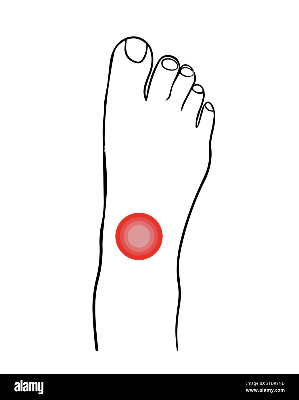 Vector isolated illustration of ankle pain Stock Vector Image & Art - Alamy