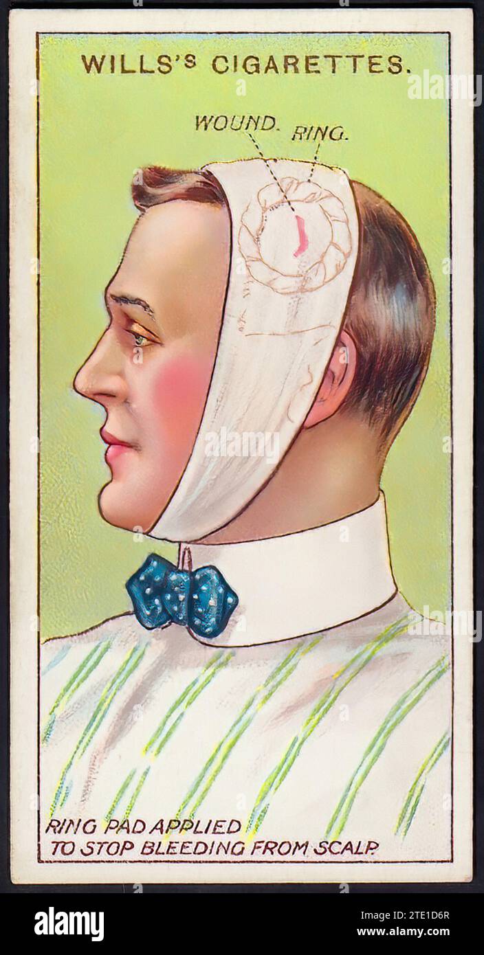 Key Learning Points: Unscheduled Bleeding On HRT Australia