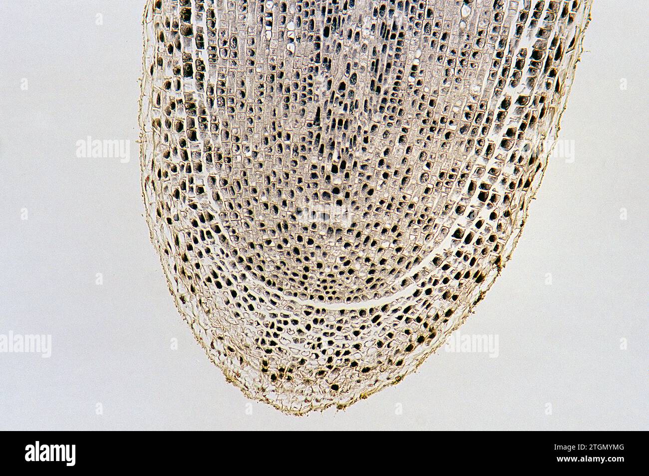 Calyptra or root cap protecting meristematic tissue of onion root. Cells on mitosis. Stock Photo