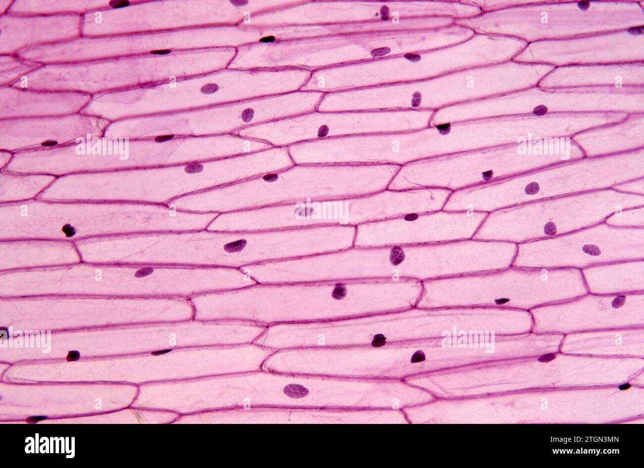 Epidermis of onion (Allium cepa) with cells, nucleus and walls.  Photomicrograph Stock Photo - Alamy
