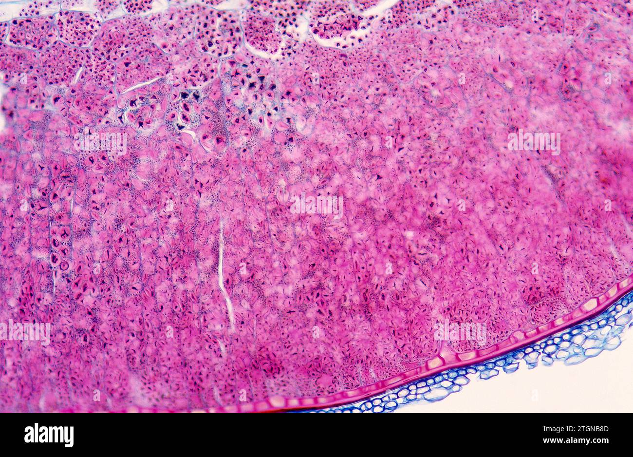 Reserve parenchyma, cross section. Photomicrograph. Stock Photo