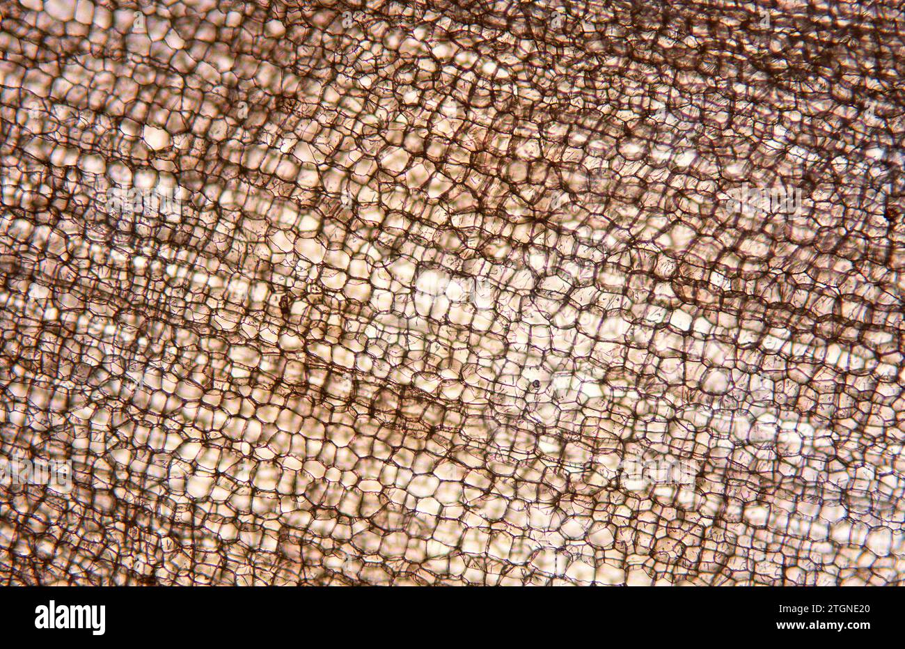 Cork or phellem layer is a protective plant tissue composed by dead