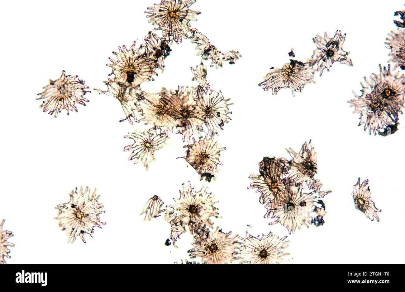 Elaeagnus trichomes (stellate hairs). Photomicrograph Stock Photo Alamy — free download