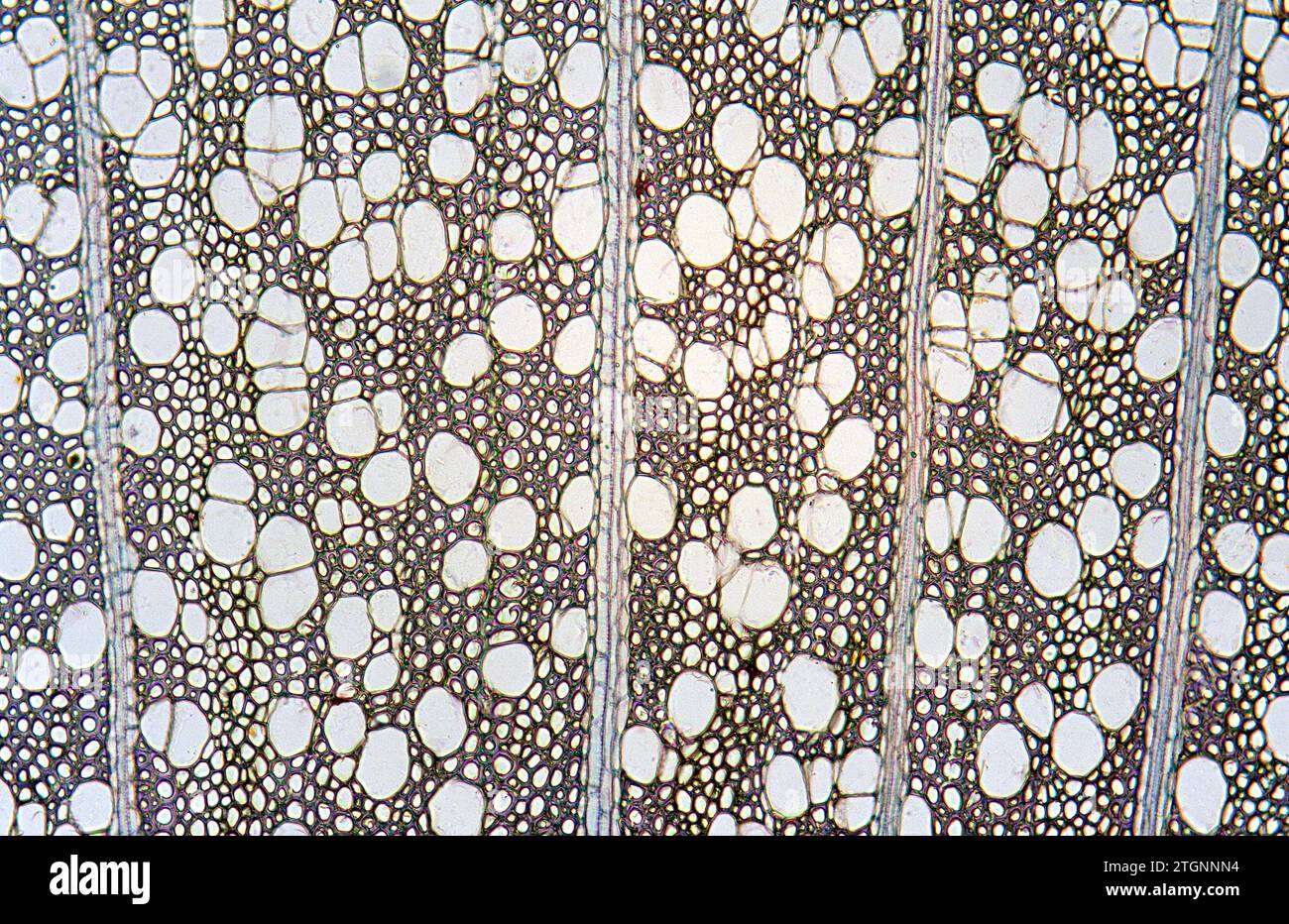 Stem cross section showing secundary xylem and radial parenchima. Photomicrograph. Stock Photo