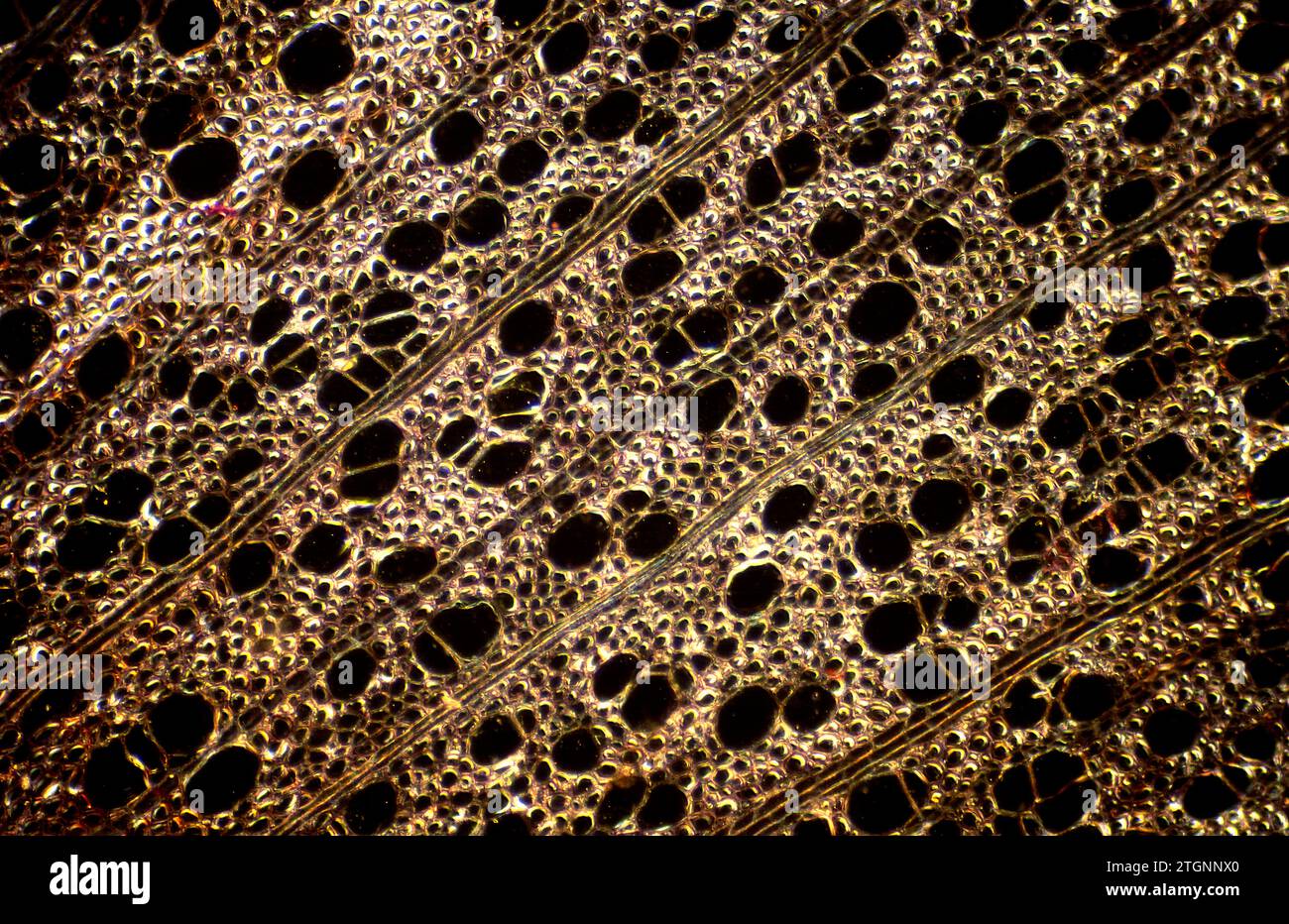 Stem cross section showing secundary xylem and radial parenchima. Photomicrograph dark background. Stock Photo