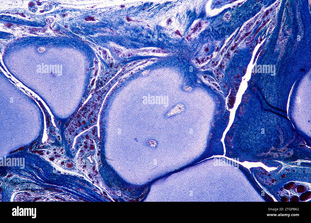 Cartilage in ossification process. Photomicrograph. Stock Photo