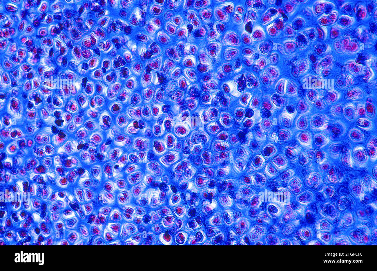 Hyaline cartilage is a kind of cartilage tissue. Photomicrograph. Stock Photo