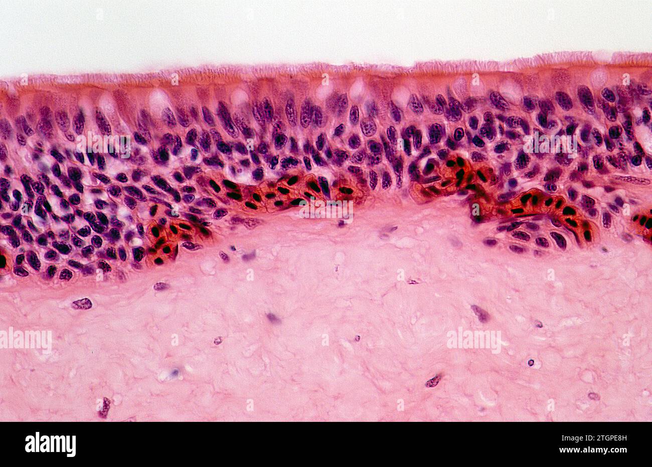 Pseudostratified columnar ciliated epithelium is a kind of epithelium present on a trachea