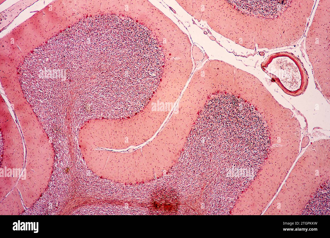 Human cerebellum section showing fisures, neurons, Purkinje cells and blood vessel. Photomicrograph. Stock Photo