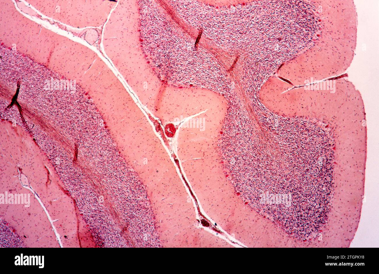 Human cerebellum section showing fisures, neurons, Purkinge cells and blood vessel. Photomicrograph. Stock Photo