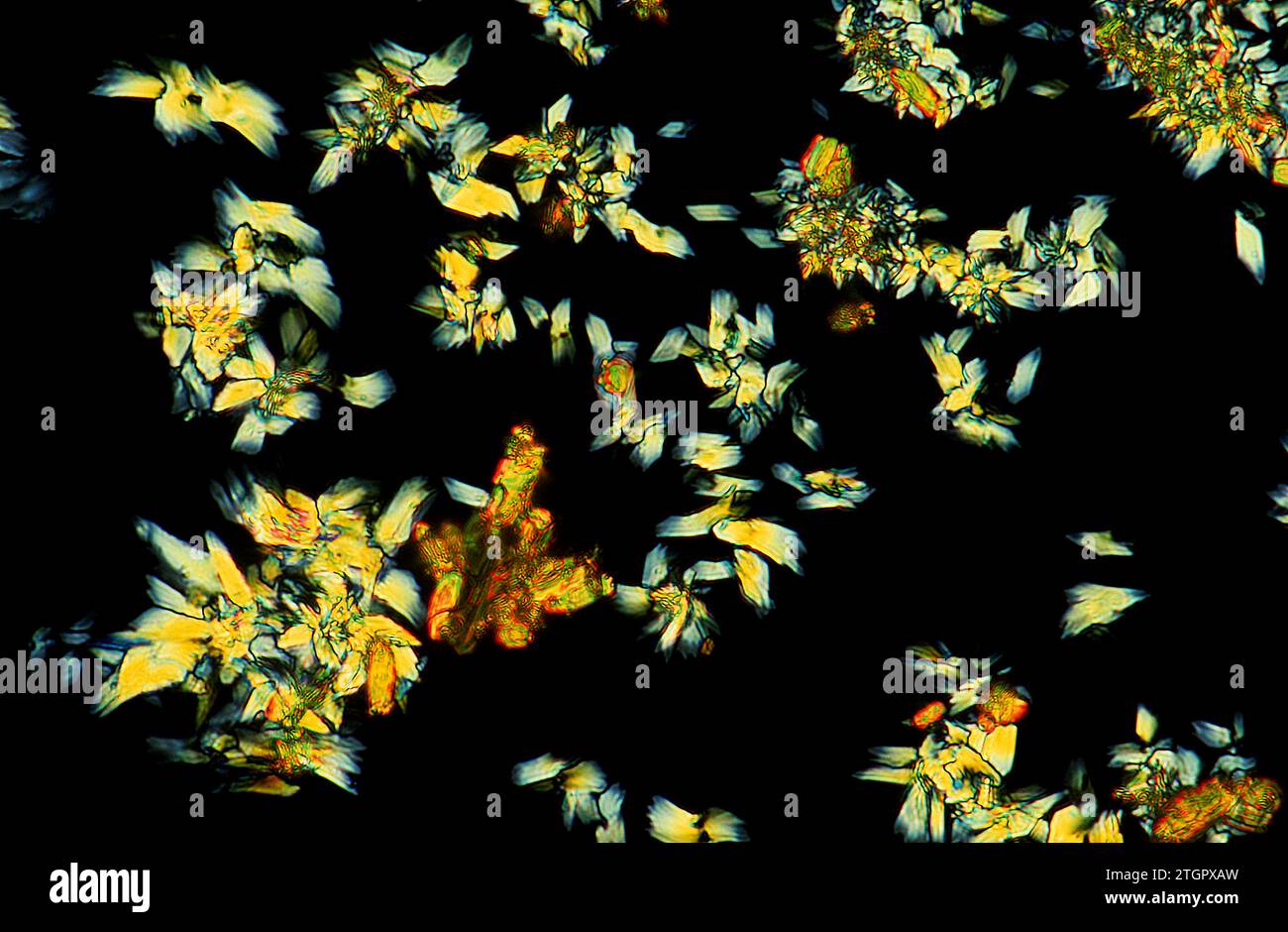 Vitamin A crystals. Photomicrograph, polarized light. Stock Photo
