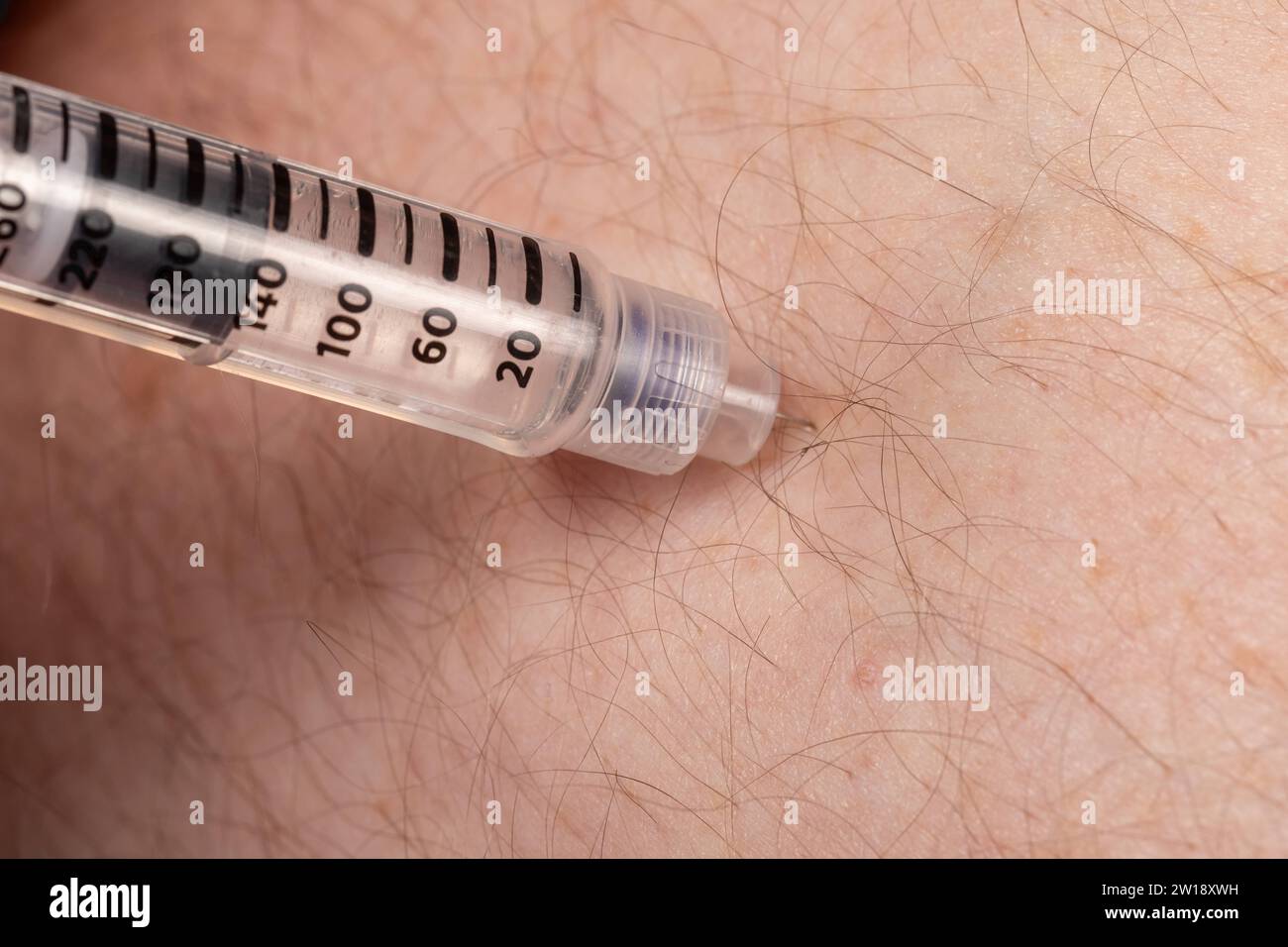 Diabetes Management: Injecting Insulin into Belly with Insulin Pen Stock Photo