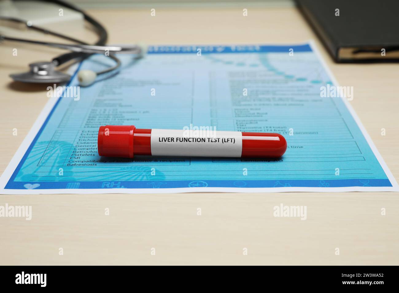 Liver Function Test. Tube with blood sample and laboratory form on