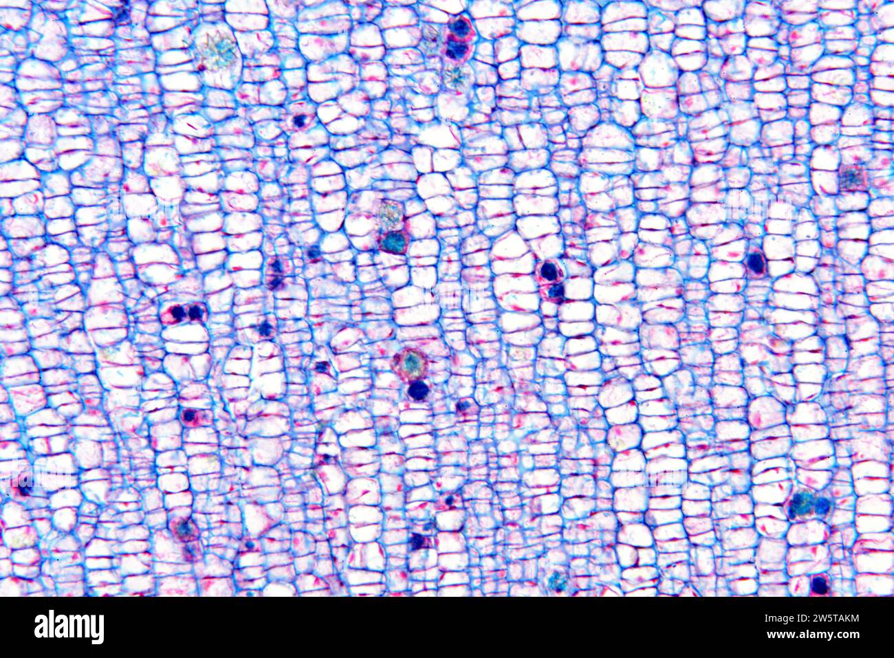 Raphides of calcium oxalate in a plant cellules. Photomicrograph X100 at 10cm wide. Stock Photo