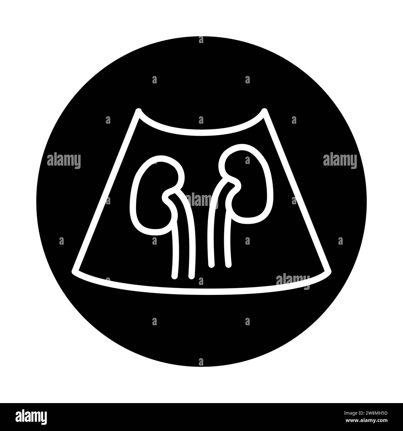gabapentin kidneys