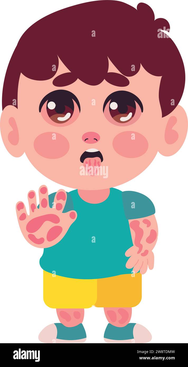 kawasaki disease boy Stock Vector Image & Art - Alamy