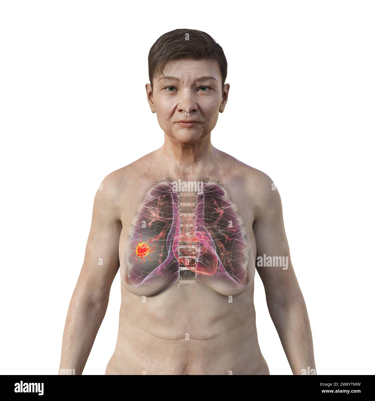 Illustration of the upper part of a woman with transparent skin