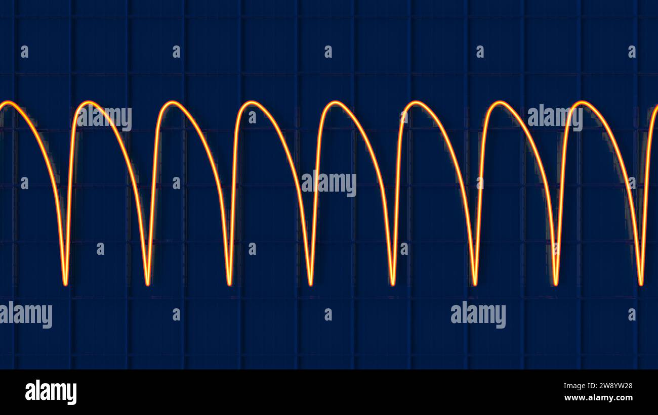 Ventricular tachycardia heartbeat rhythm, illustration Stock Photo