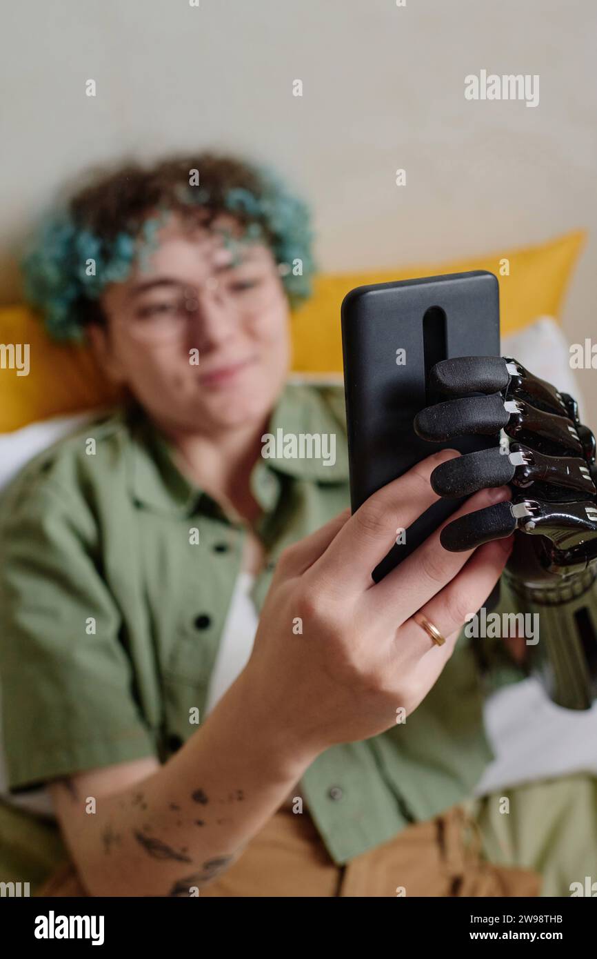 Young woman with prosthetic arm uploading photos on social media to meet new friends Stock Photo