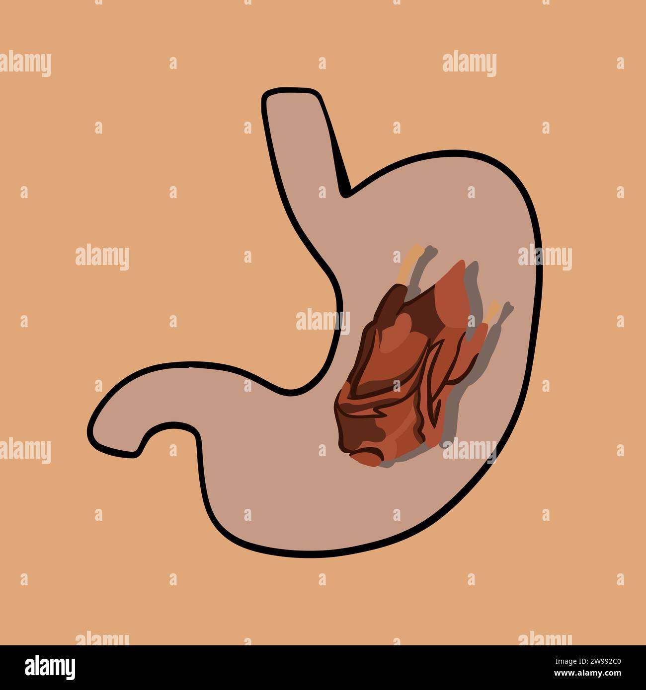 Vector isolated illustration of meat digestion. Overeating on holidays. Turkey digestion