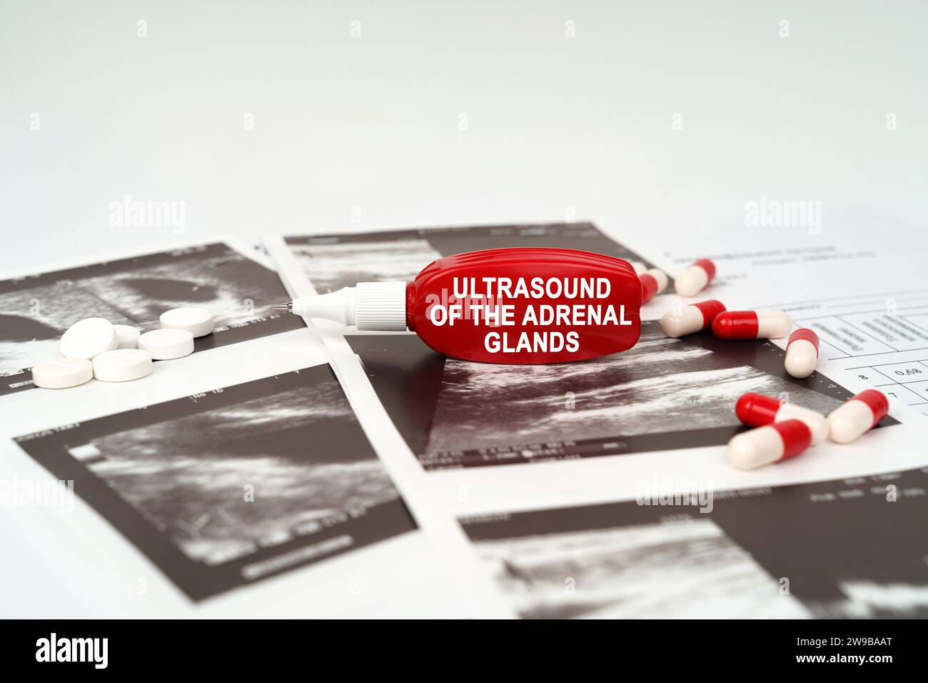 Medical concept. On the ultrasound pictures there are pills and a pen with the inscription - Ultrasound of the adrenal glands Stock Photo