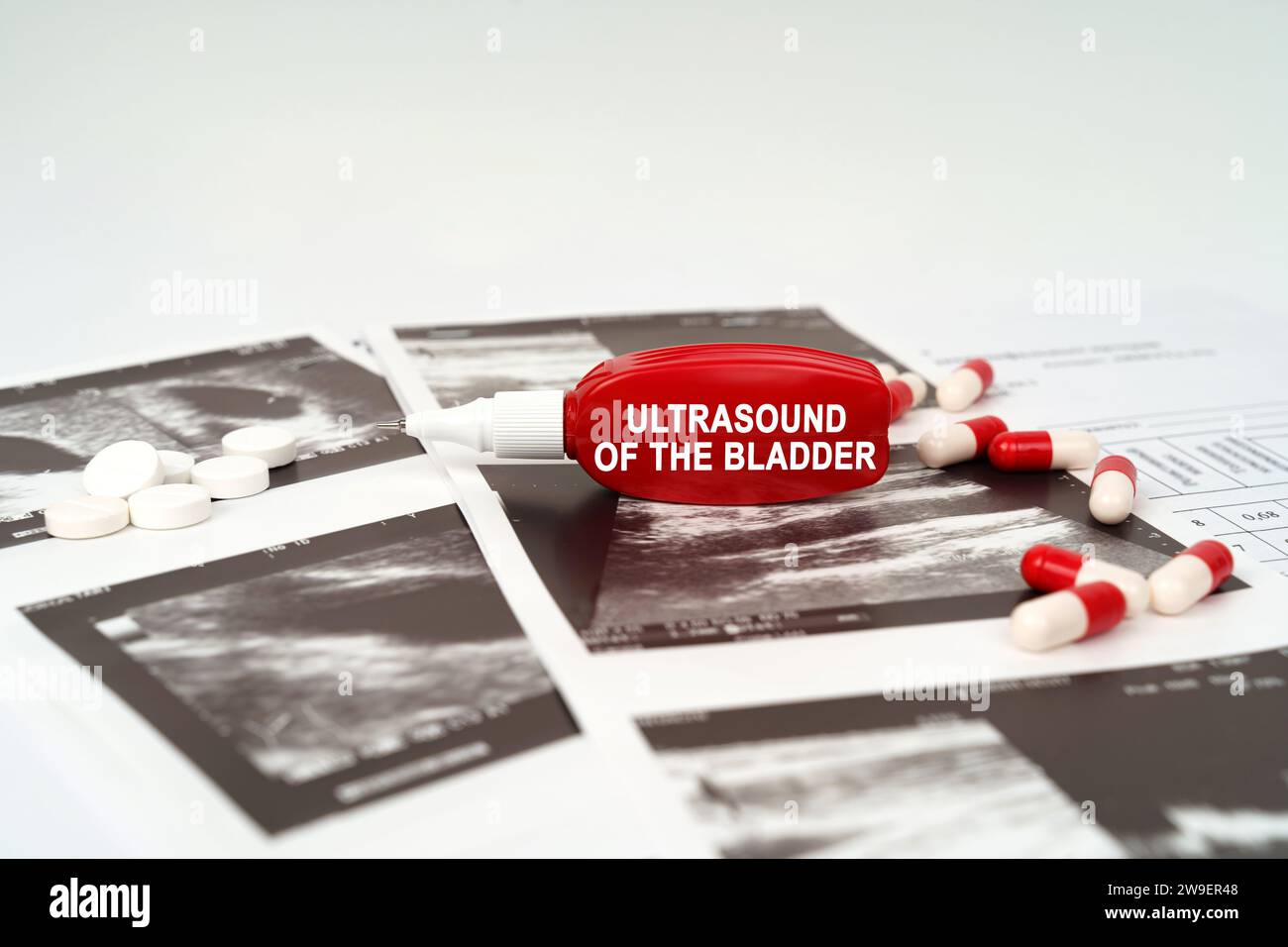 Medical concept. On the ultrasound pictures there are pills and a pen with the inscription - Ultrasound of the bladder Stock Photo
