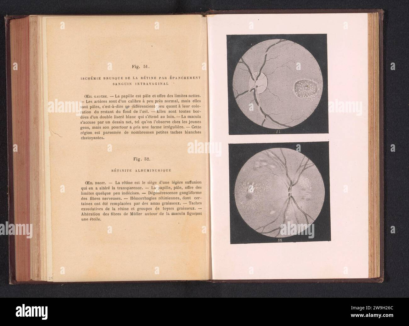 Image before the retina hi-res stock photography and images - Alamy