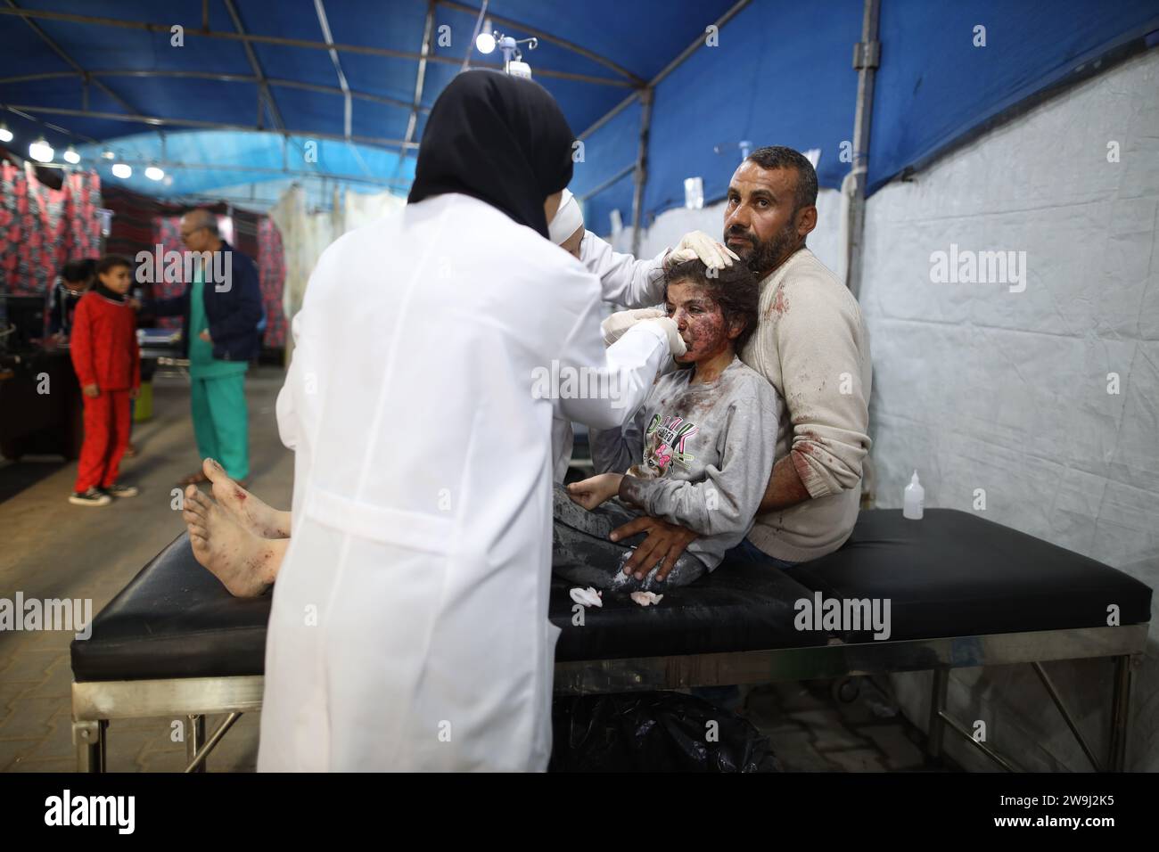 Gaza. 28th Dec, 2023. An injured girl is treated at a hospital near Nuseirat Refugee Camp, central Gaza Strip, on Dec. 28, 2023. The number of Palestinian deaths due to Israel's attacks on the Gaza Strip has risen to 21,320 with 55,603 injured, said the Gaza Health Ministry on Thursday. Credit: Xinhua/Alamy Live News Stock Photo