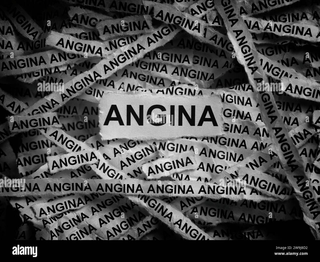 Strips of newspaper with the words Angina typed on them. Black and white. Close up. Stock Photo