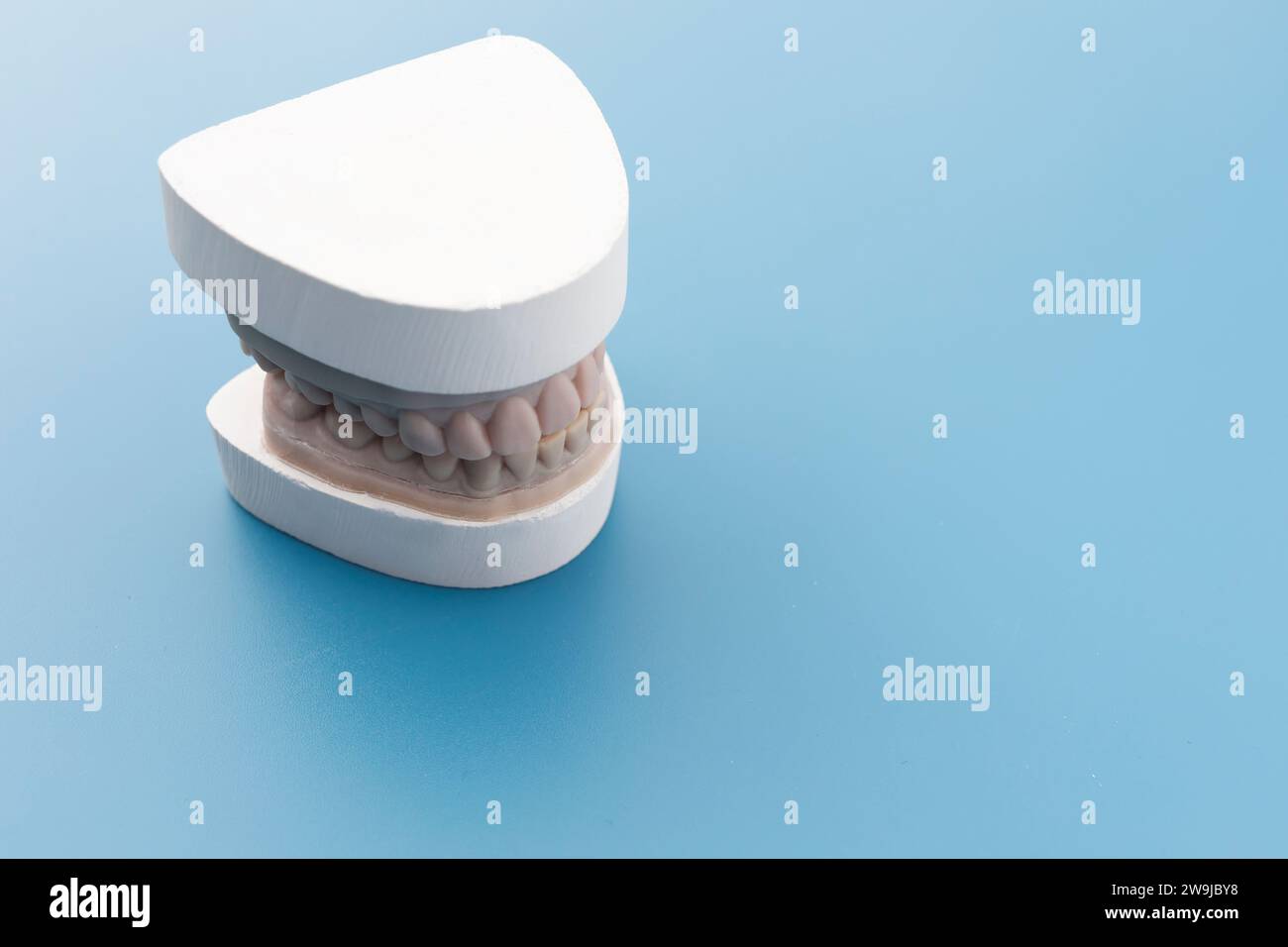 Dental Mold, Gypsum Model Plaster Cast For Teeth Molar In Laboratory On