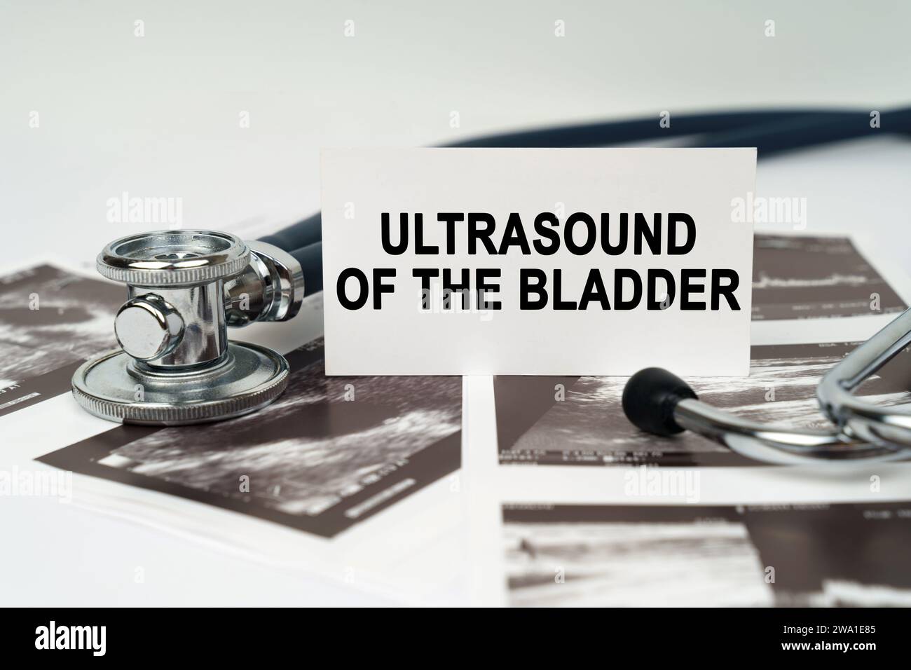 Medical concept. On the ultrasound pictures there is a stethoscope and a business card with the inscription - Ultrasound of the bladder Stock Photo