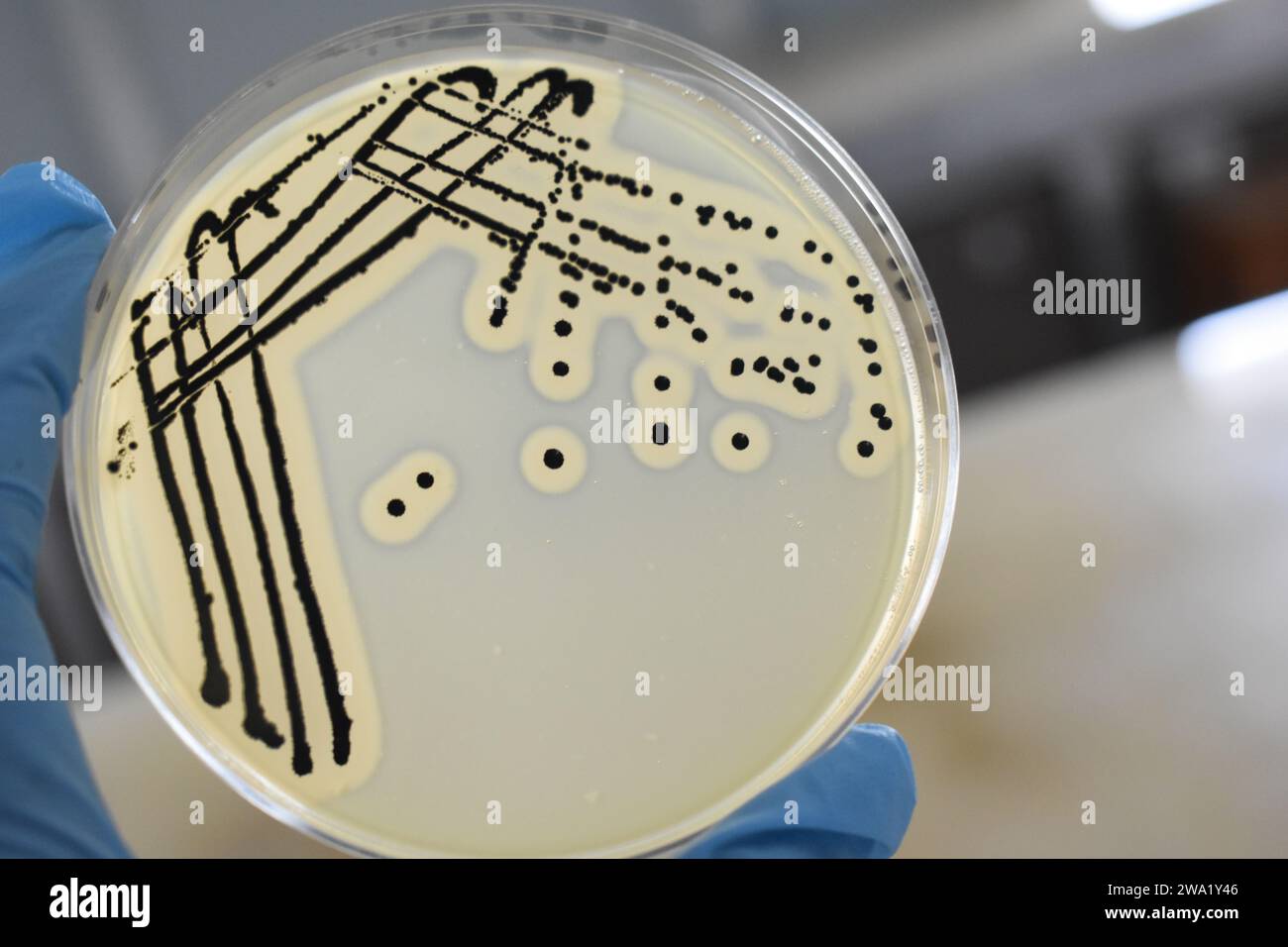 A quadrant streak of the bacterium, Staphylococcus aureus cultured or inoculated on a Baird-Parker agar plate with egg tellurite. Stock Photo