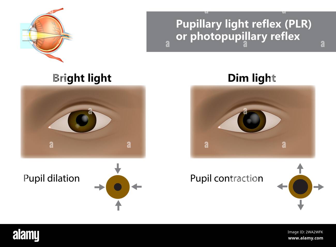 Pupillary light reflex PLR or photopupillary reflex. How do pupils