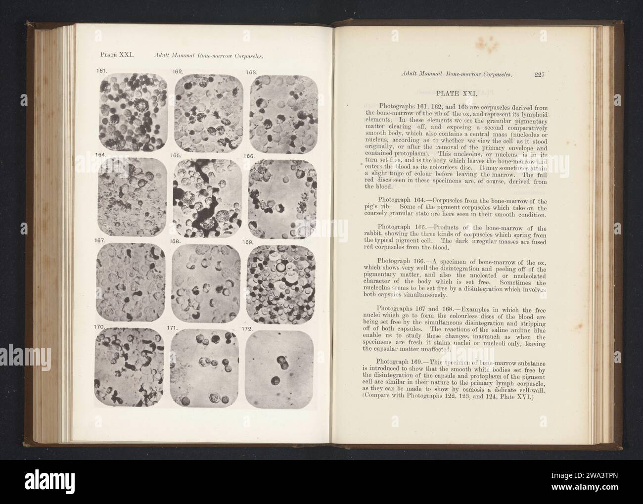 Bone cell magnification hi-res stock photography and images - Alamy