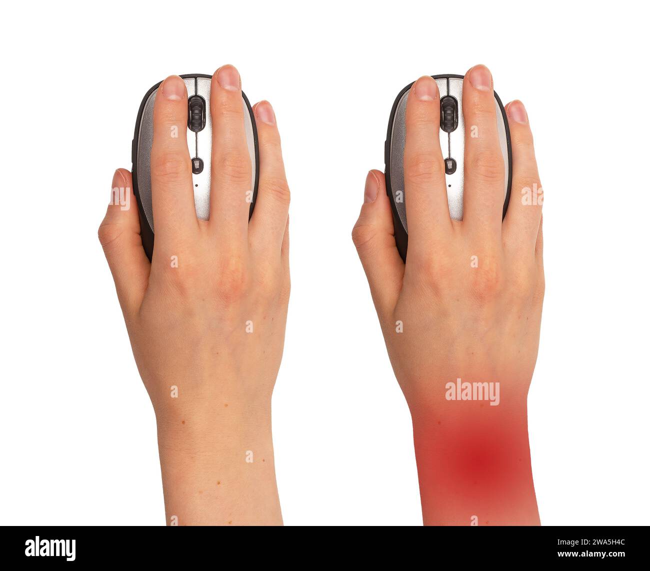 Healthy vs unhealthy ill pain in wrist, hand on computer mouse