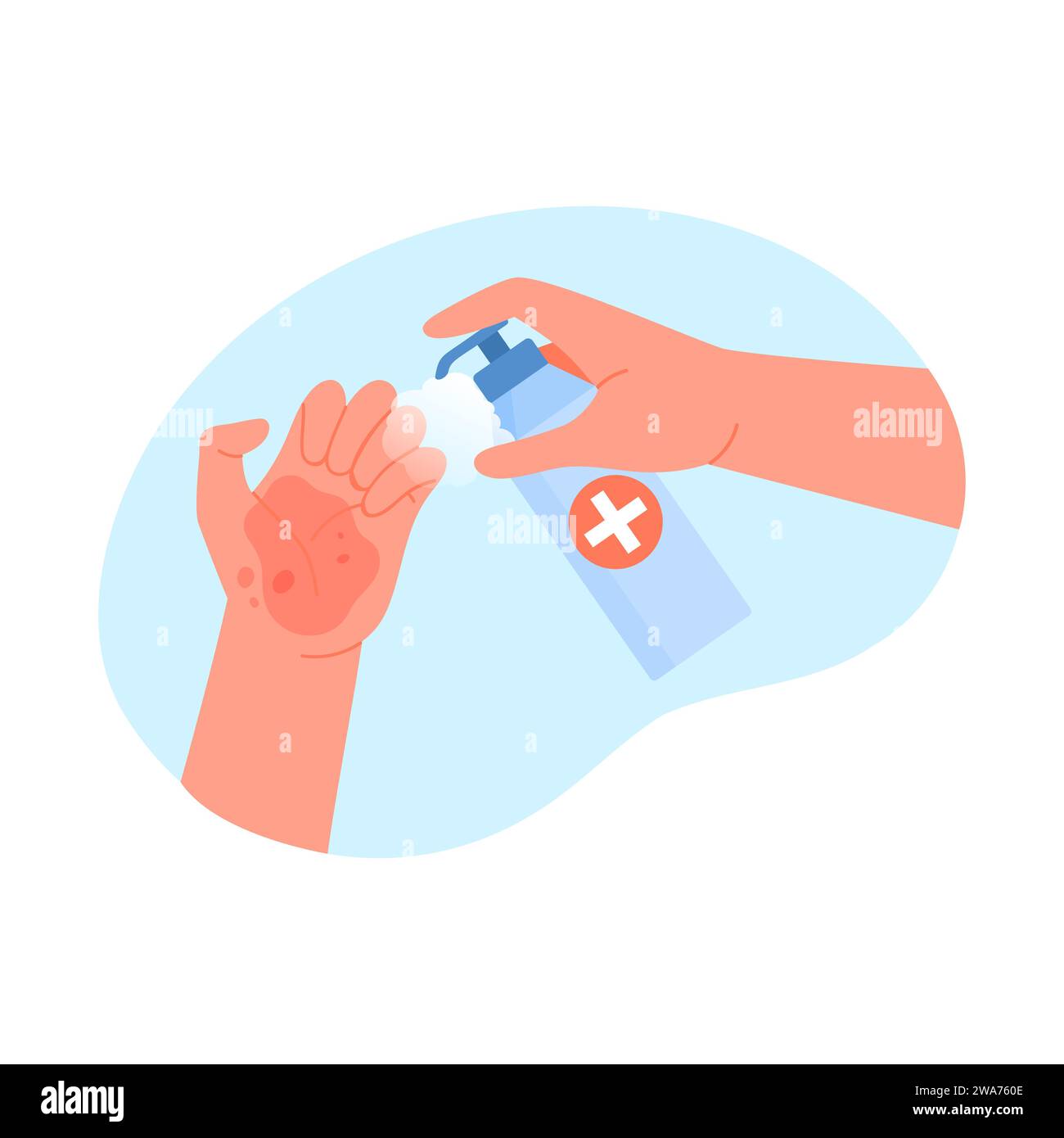 Injured hand disinfection. First aid, wound cleaning solution cartoon