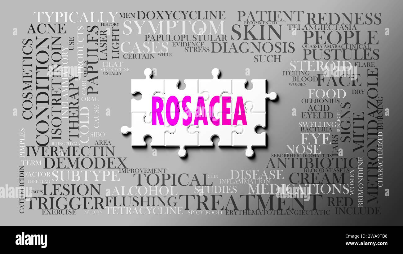 Rosacea - a complex subject, related to many concepts. Pictured as a puzzle and a word cloud made of most important ideas and phrases related to rosac Stock Photo