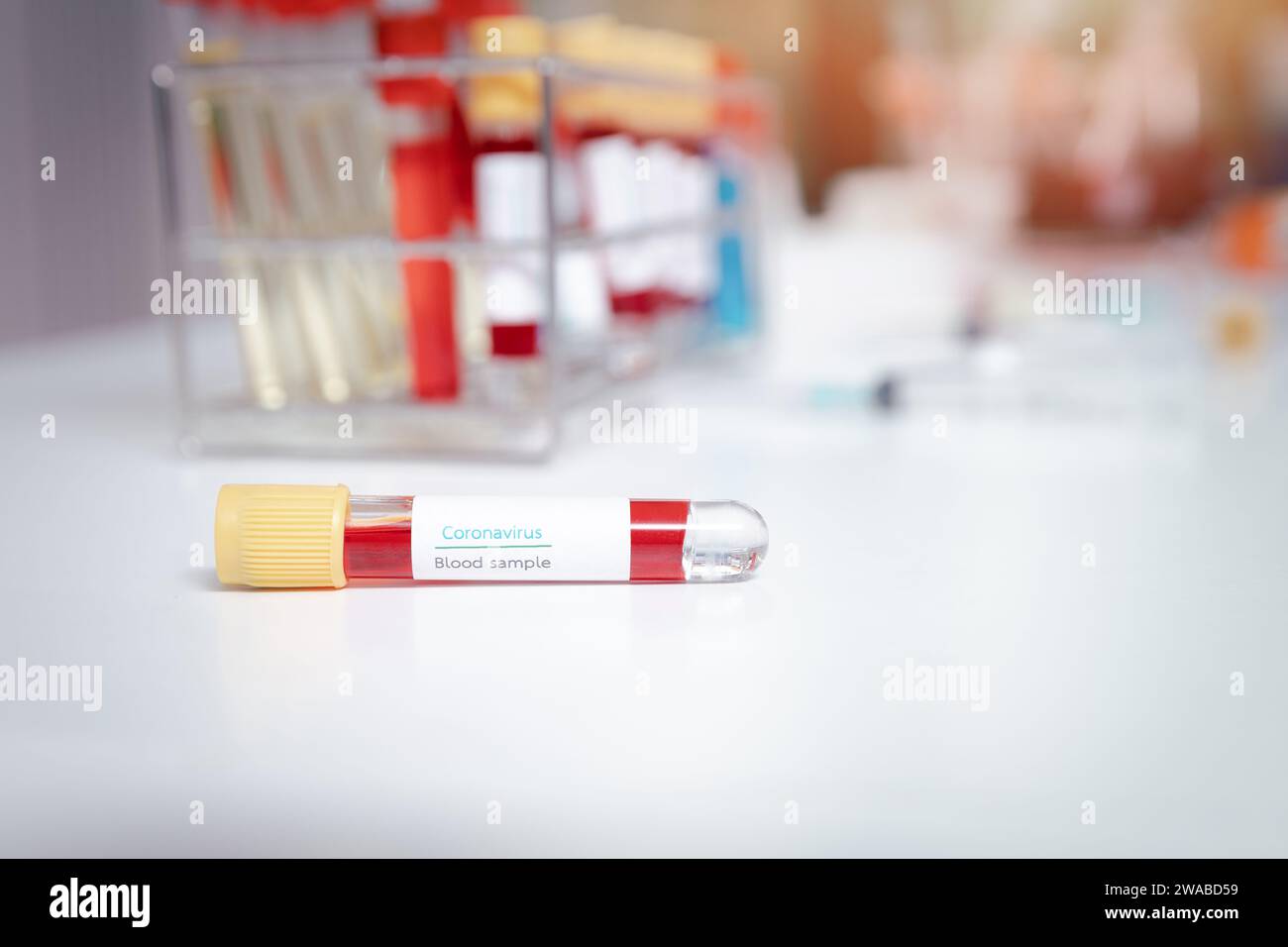 Blood samples in tubes on work table in a medical examination lab Stock ...