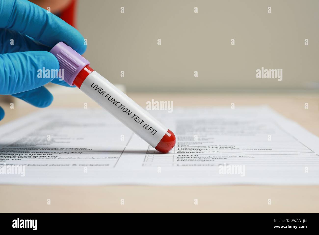 Liver Function Test. Laboratory worker with tube of blood sample and
