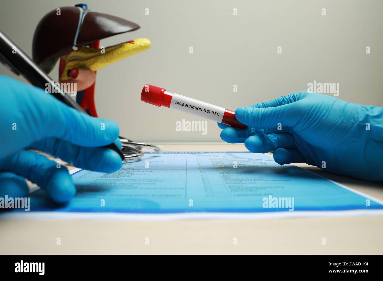 Liver Function Test. Laboratory worker with tube of blood sample