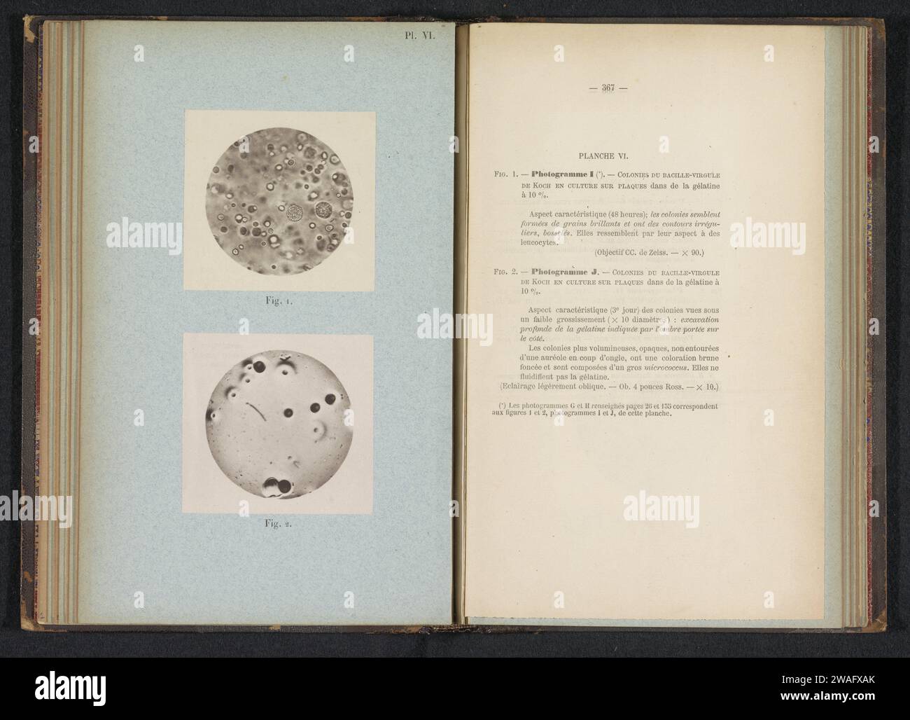 Two microscope recordings from Cholera, Émile van Ermemgem, c. 1875 ...