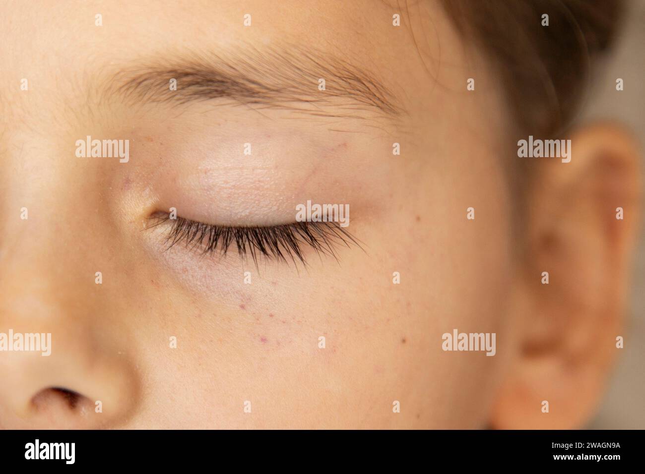 hemorrhage-multiple-health-spot-infant-white-care-diagnose-ill