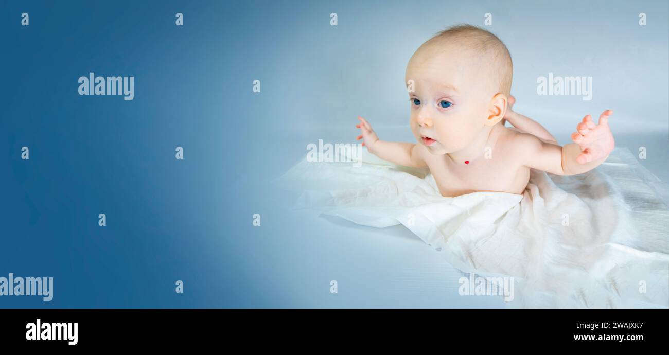 a baby with a hemangioma on his neck lies on a blue background Stock Photo